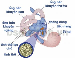 chóng mặt khi thay đổi tư thế