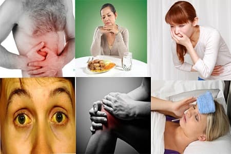 triệu chứng bệnh ở gan