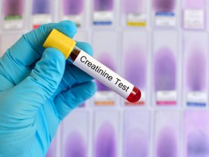 xét nghiệm creatinine