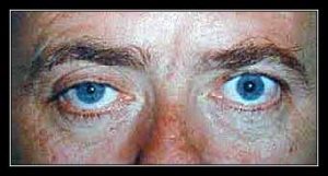 CLAUDE BERNARD – HORNER 