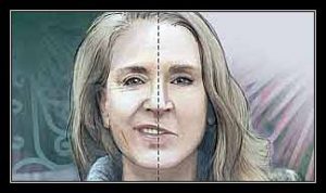 co cơ nửa mặt ngoại vi