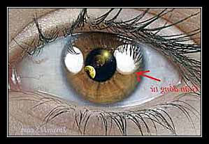 GIÃN ĐỒNG TỬ MỘT BÊN