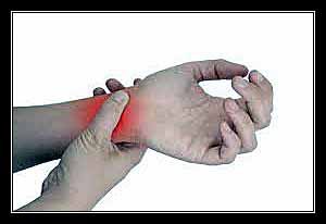 mất mạch cổ tay