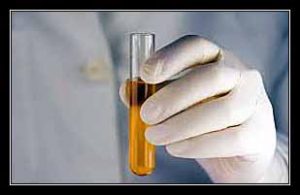 nước tiểu đục