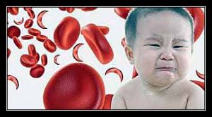 thiếu máu ở trẻ em