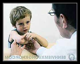 thấp đa khớp ở trẻ