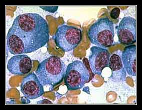 TƯƠNG BÀO HUYẾT (Plasmocyte) TRONG MÁU và TRONG TỦY