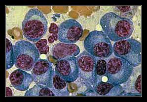 tương bào huyết