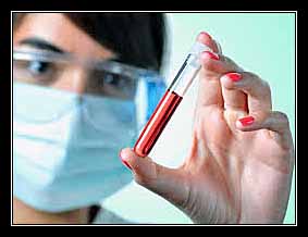 tốc độ máu lắng