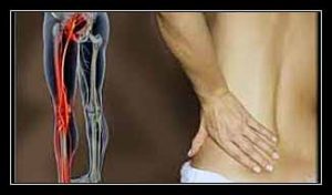 viêm nhiều dây thần kinh