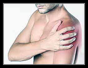 viêm khớp vai - cánh tay