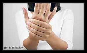 viêm đa rễ dây thần kinh