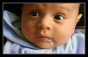 ÓI MỬA Ở TRẺ CÒN BÚ