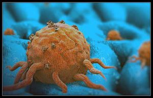 TỔNG QUAN VỀ UNG THƯ