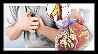 đau thắt ngực