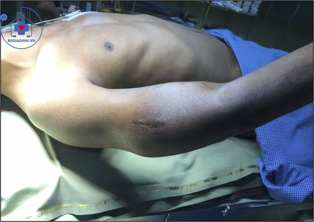 Cậu Bé 16 Tuổi Đối Diện Căn Bệnh Ung Thư Xương: Giấc Mơ Bóng Đá Đang Tan Biến