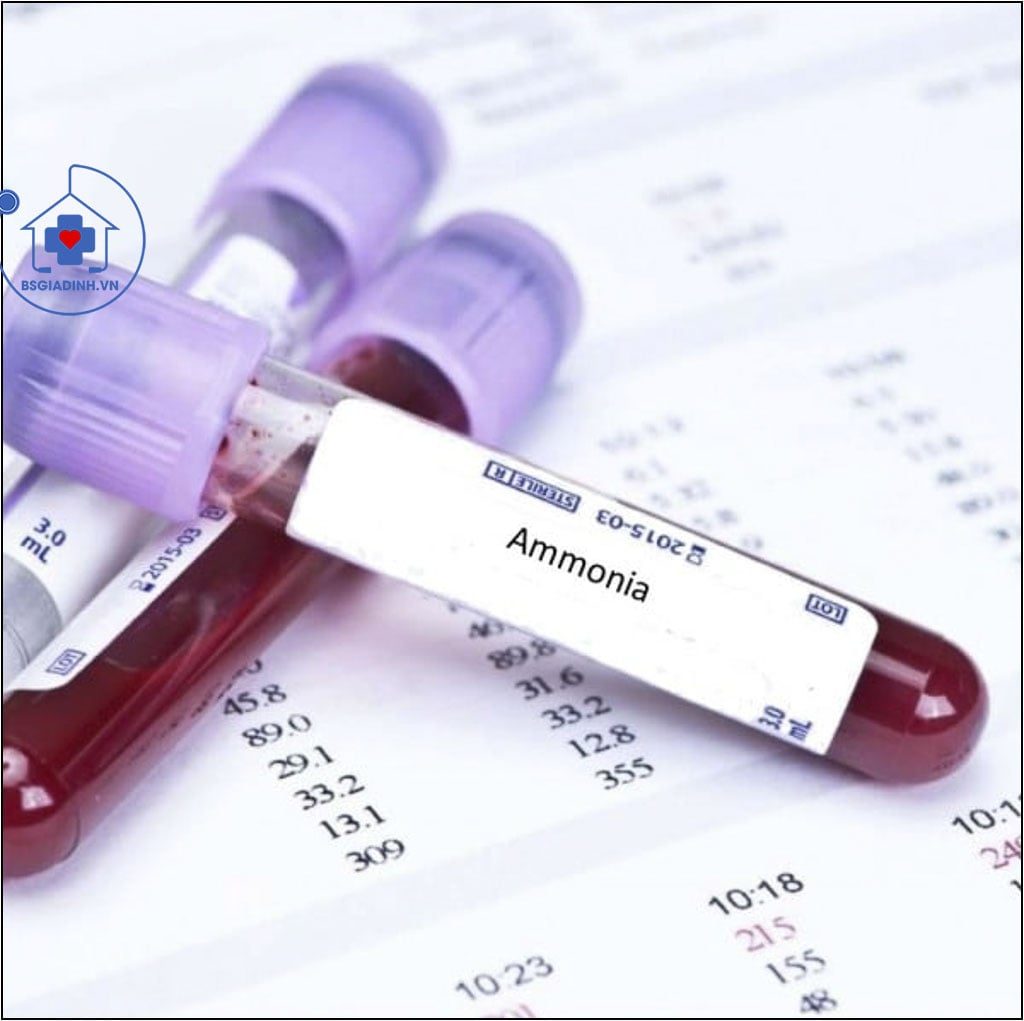 AMMONIAC MÁU (NH3, NH4)