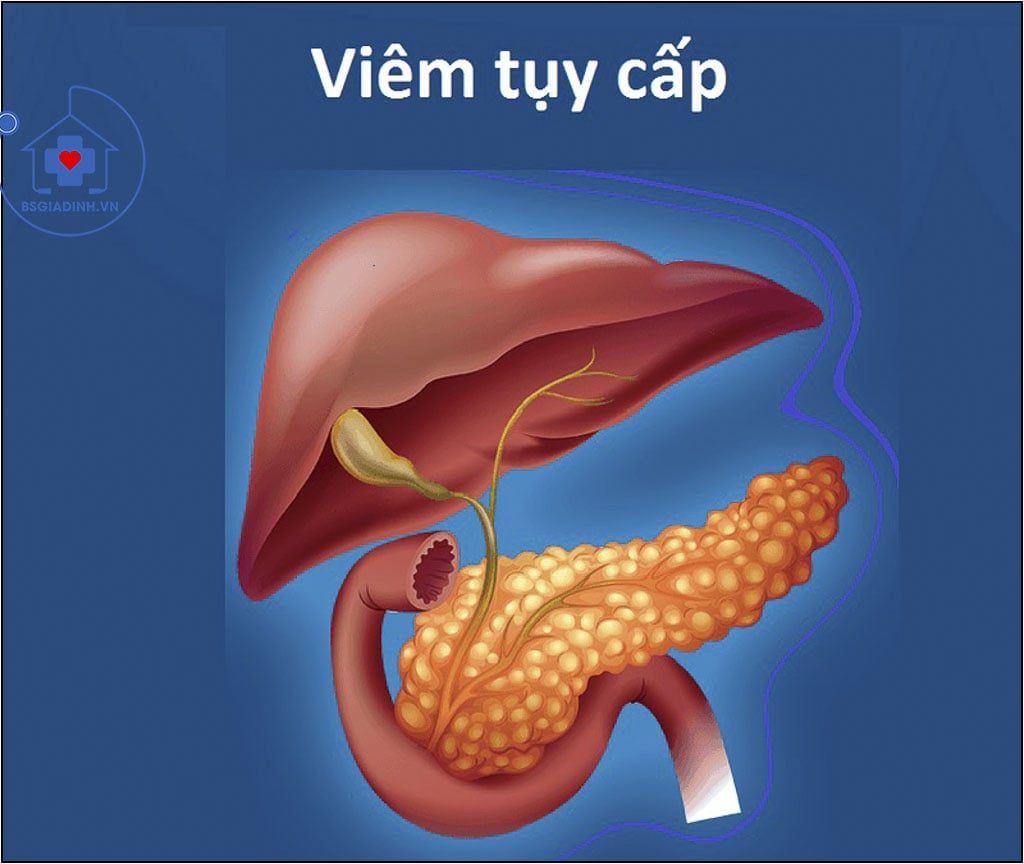 AMYLASE  trong viêm tụy