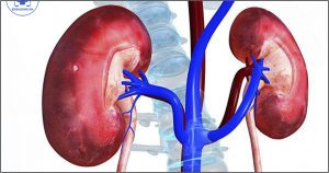 creatinin và suy thận