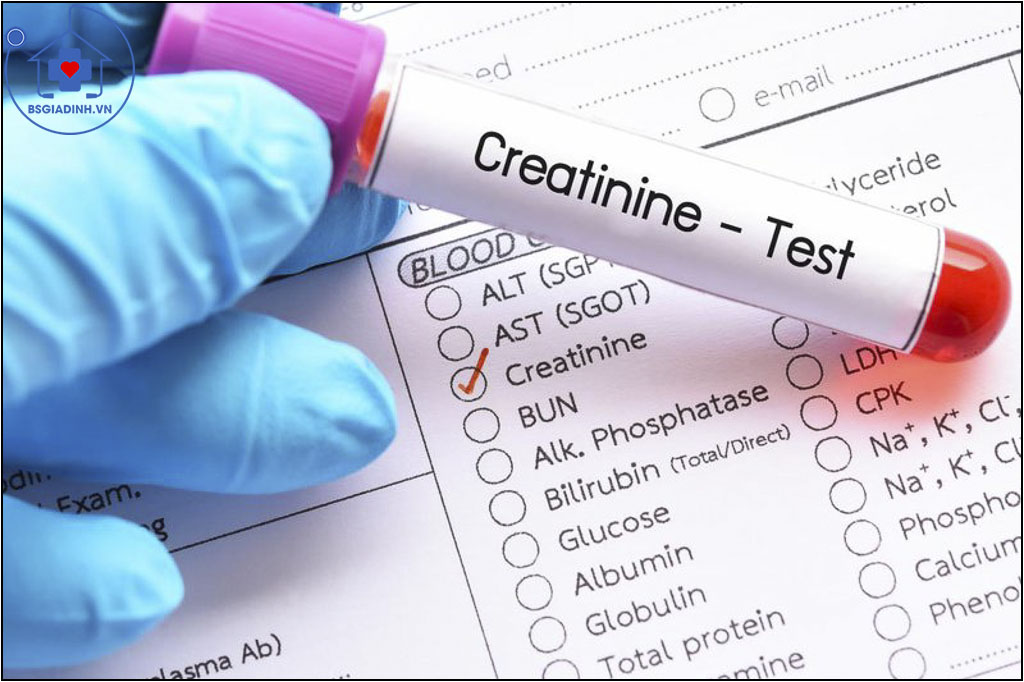 xét nghiệm creatinin