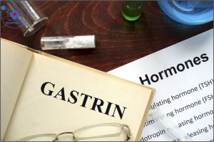 xét nghiệm GASTRIN