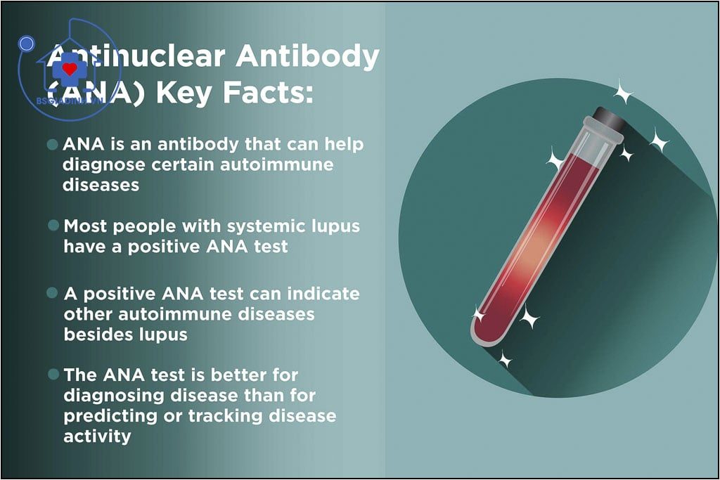 Kháng thể kháng nhân (ANA)