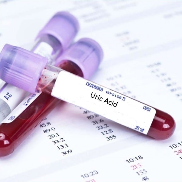 mẫu xét nghiệm acid uric máu