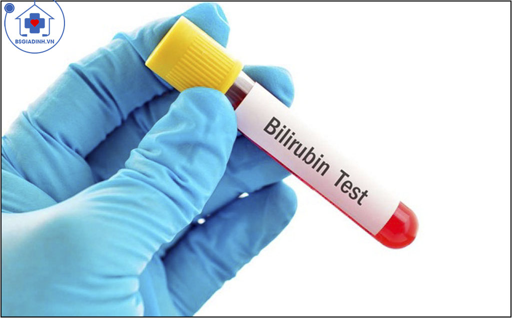 xét nghiệm Bilirubin