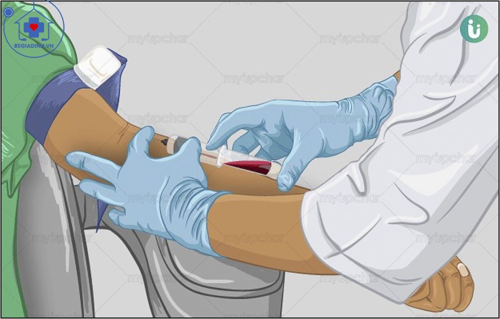 Chuỗi nhẹ tự do là gì? Ứng dụng của xét nghiệm chuỗi nhẹ tự do trong máu?