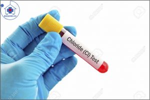 xét nghiệm clo