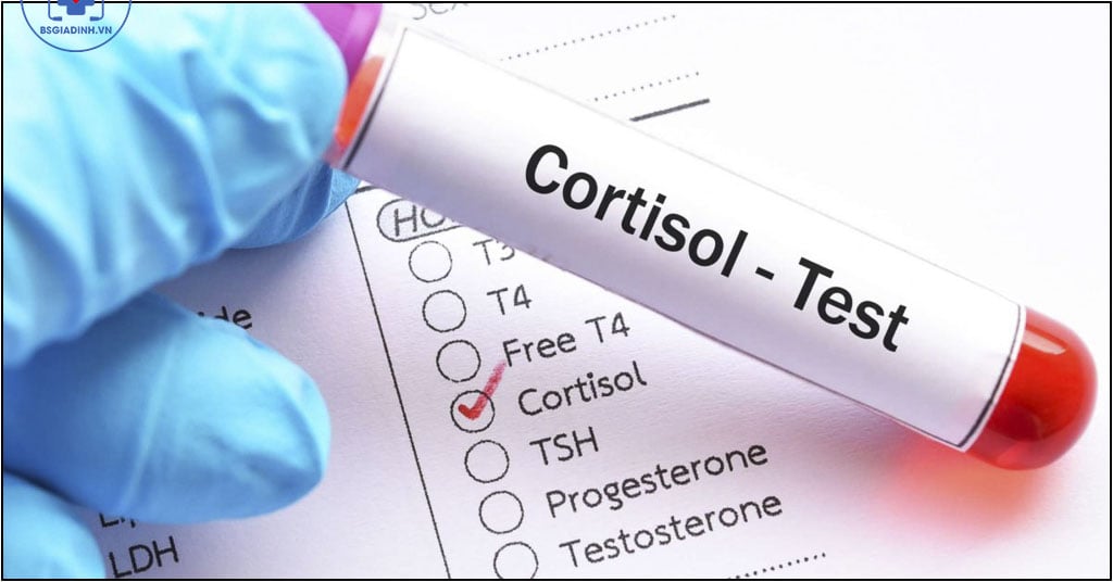 xét nghiệm CORTISOL