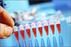 xét nghiệm d-dimer