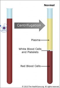 dung tích hồng cầu