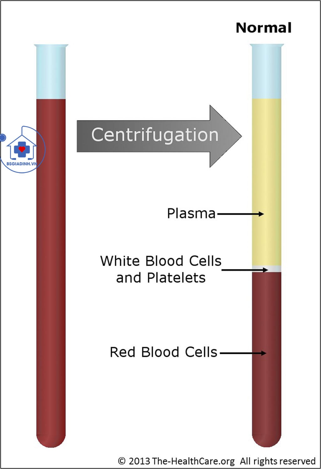 dung tích hồng cầu