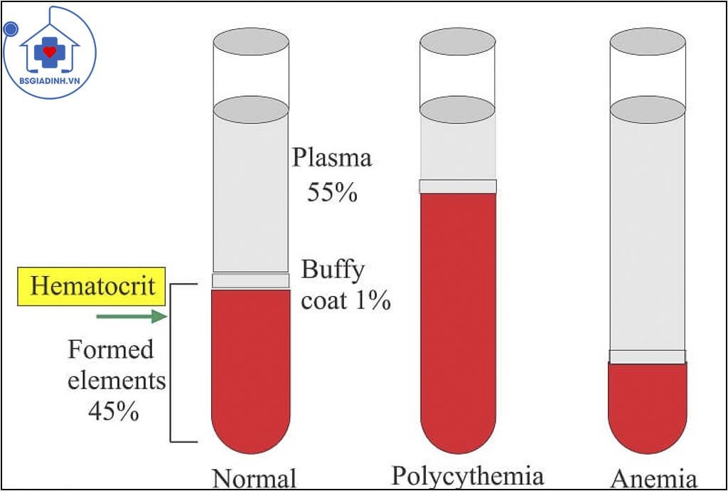 dung tích hồng cầu