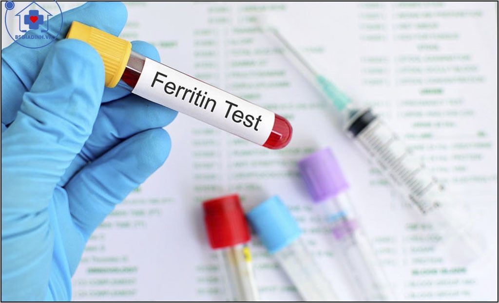 xét nghiệm ferritin 
