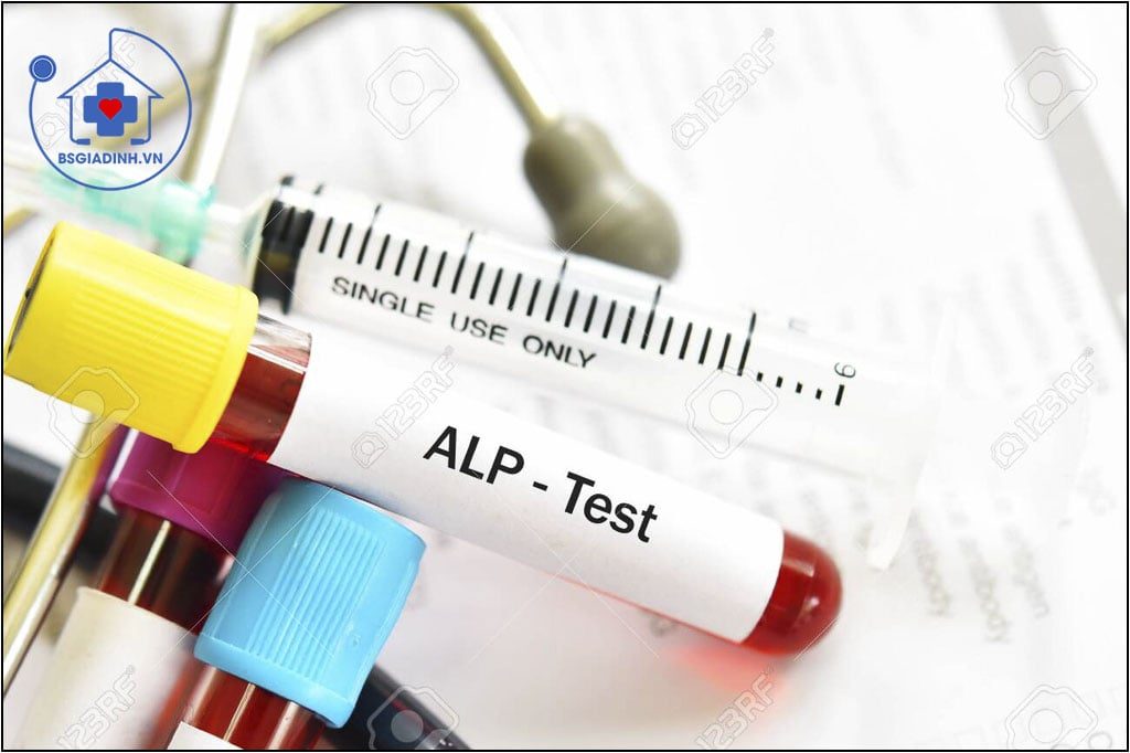 xét nghiệm ALP