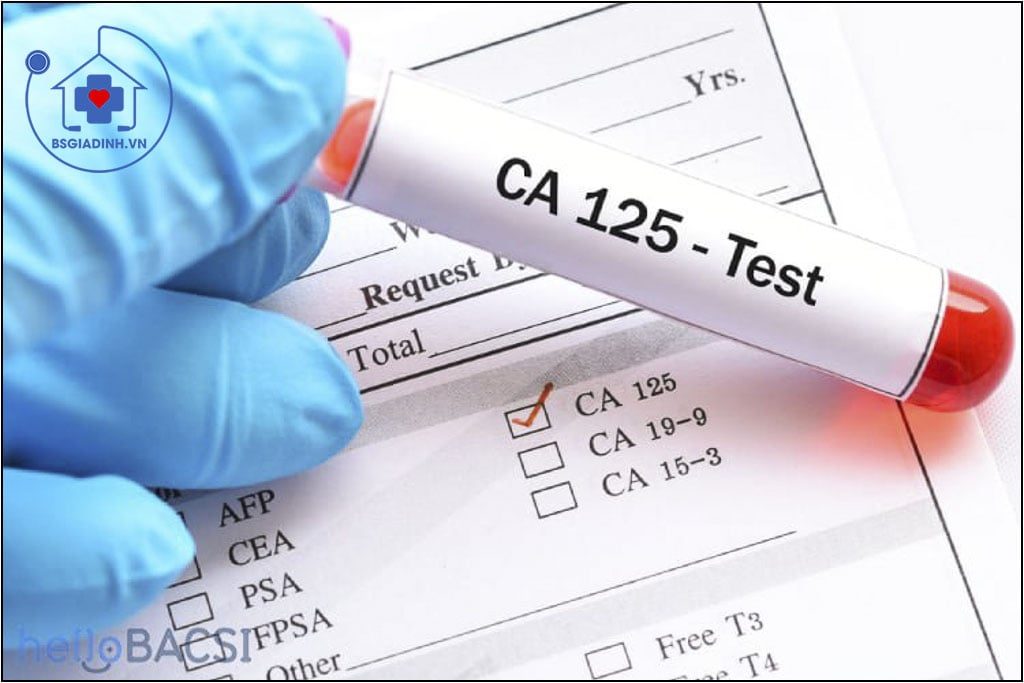 xét nghiệm CA 125