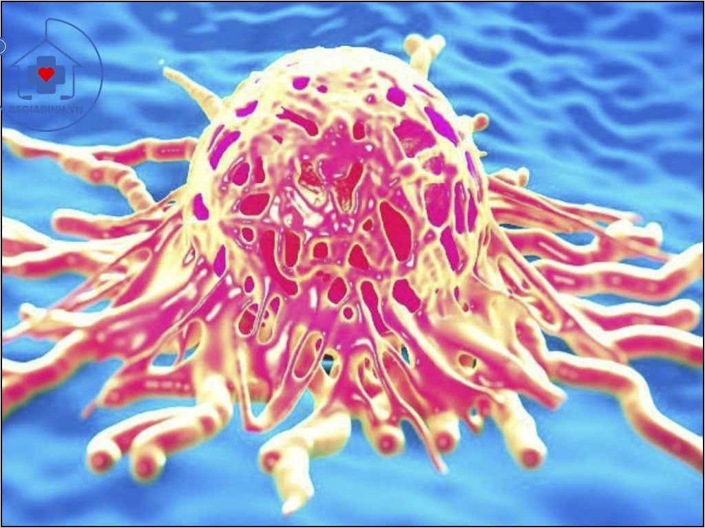 xét nghiệm CA 19-9