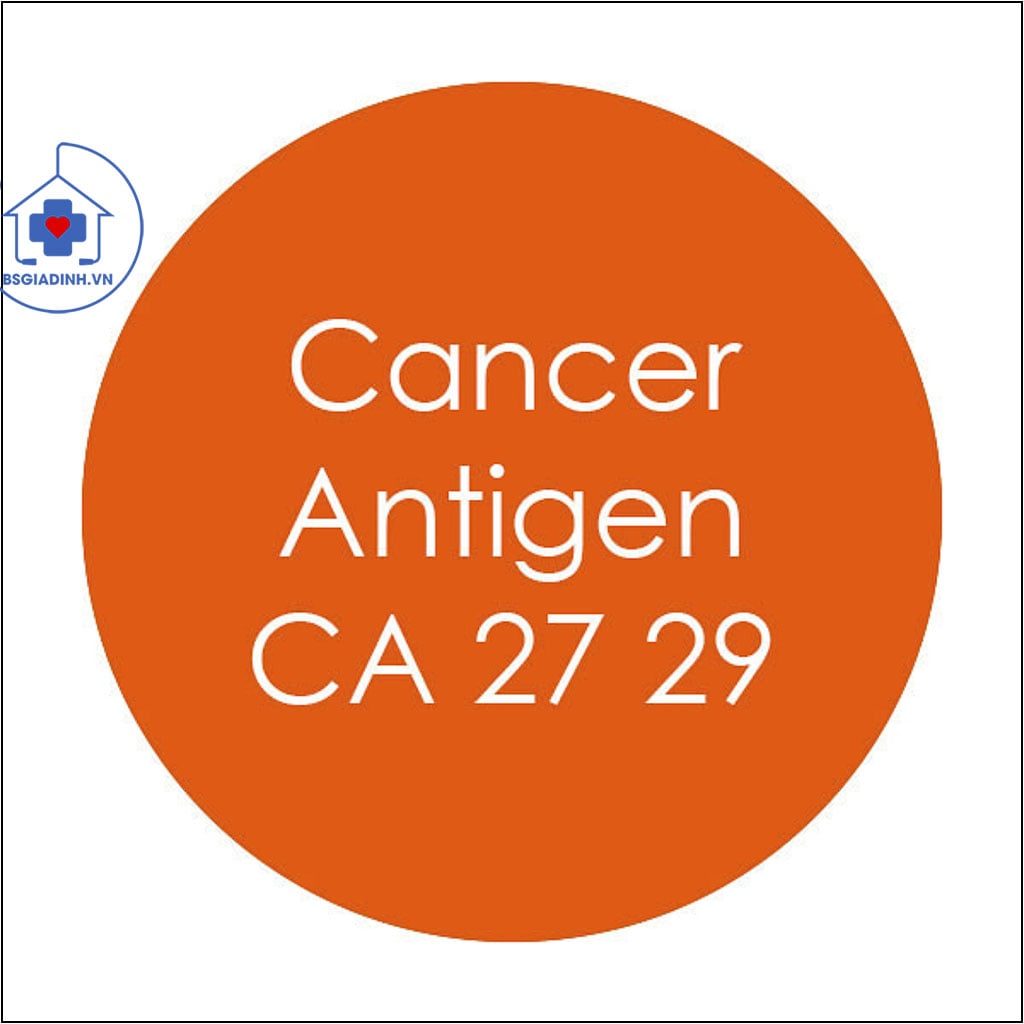 CA 27-29 là gì? Khi nào cần làm xét nghiệm CA 27-29?