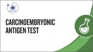 xét nghiệm CEA