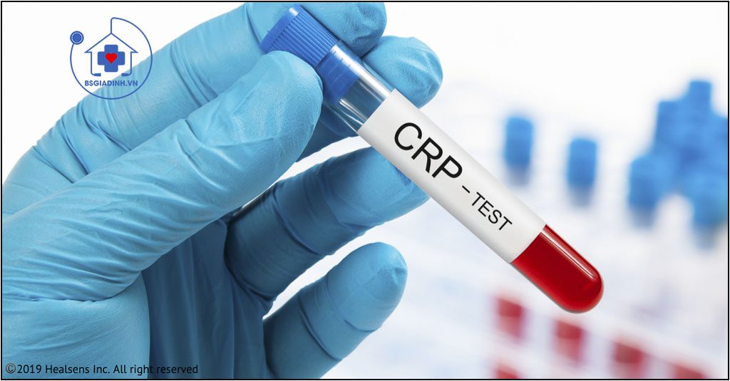 xét nghiệm CRP