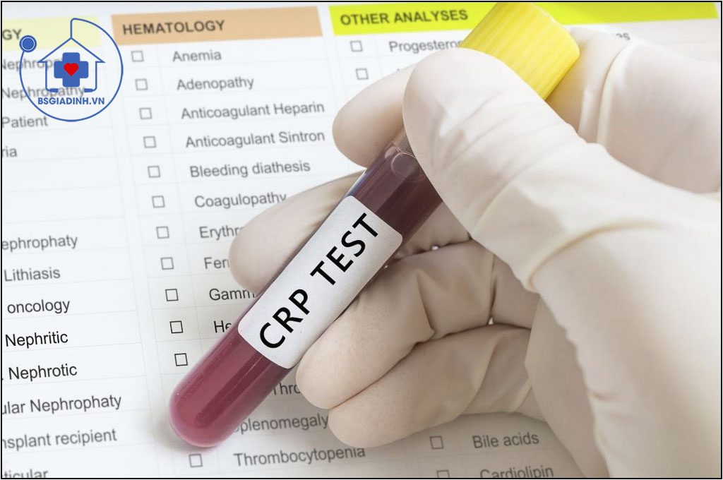 xét nghiệm CRP