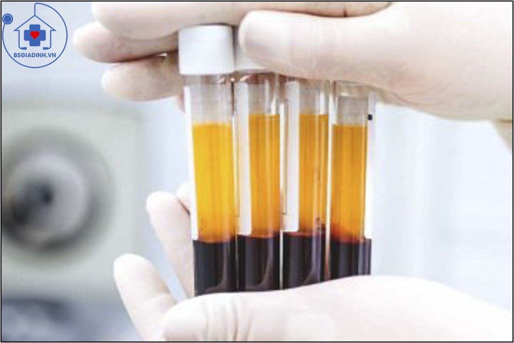 FIBRINOGEN là gì? khi nào cần xét nghiệm FIBRINOGEN ?