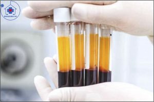 xét nghiệm FIBRINOGEN