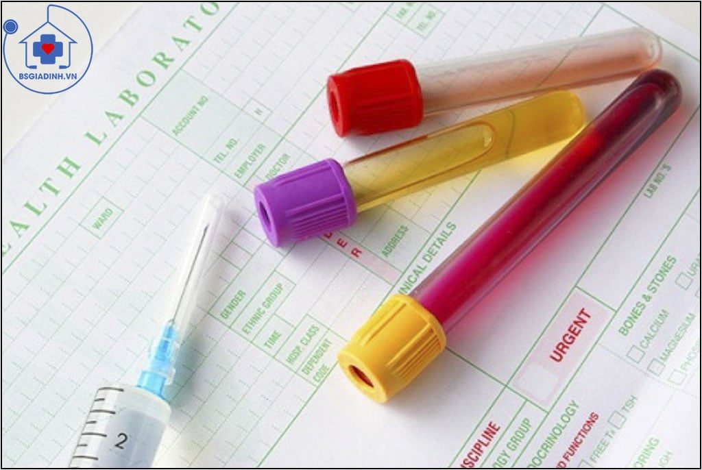 xét nghiệm FIBRINOGEN 