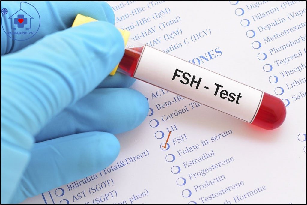 FSH là gì? Khi nào cần xét nghiệm FSH?