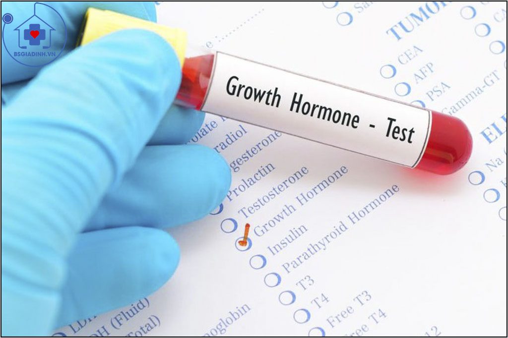 GH là gì? Khi nào cần làm xét nghiệm GH?
