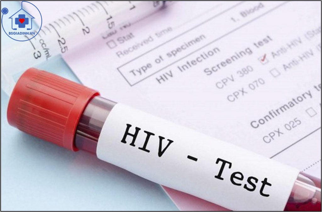 xét nghiệm HIV