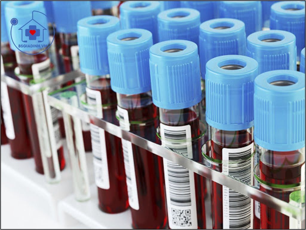 Xét nghiệm T3 tự do